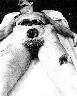 The Black Dahlia - Elizabeth Short The Black Dahlia - Elizabeth Short